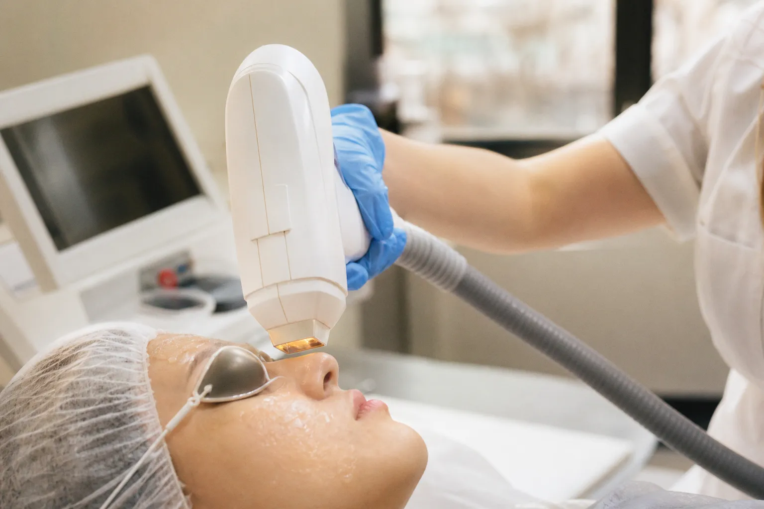 Épilation laser du visage : une efficacité à quel prix ?