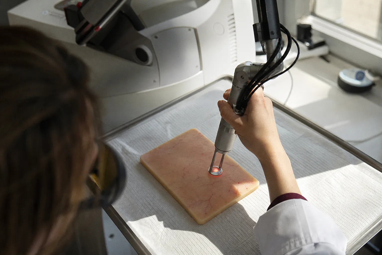 Lasers vasculaires en dermatologie esthétique : comparatif des technologies pour les lésions cutanées